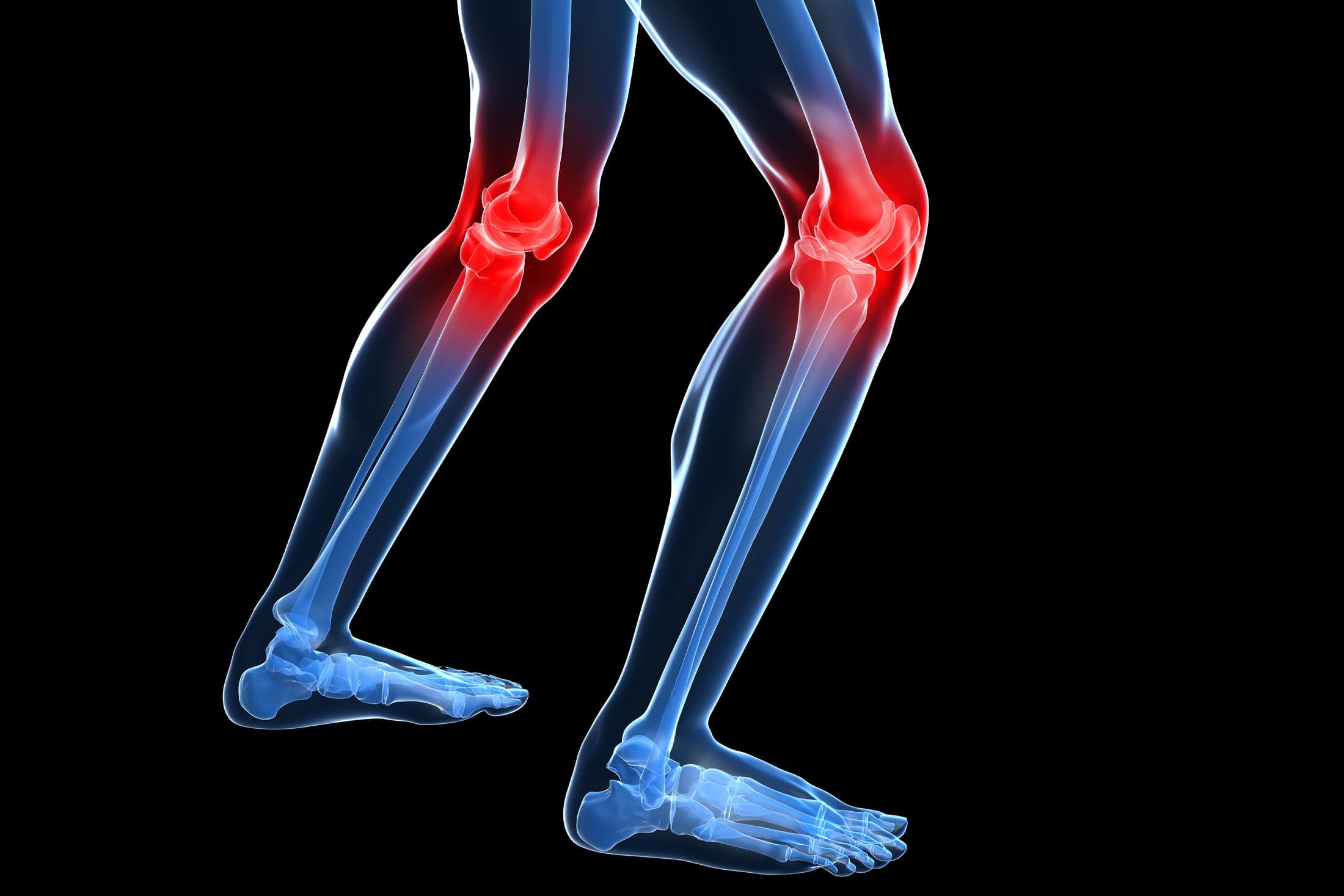 laufer-verletzen-sich-am-haeufigsten-am-knie_runners-most-often-injure-their-knees_this-is-why