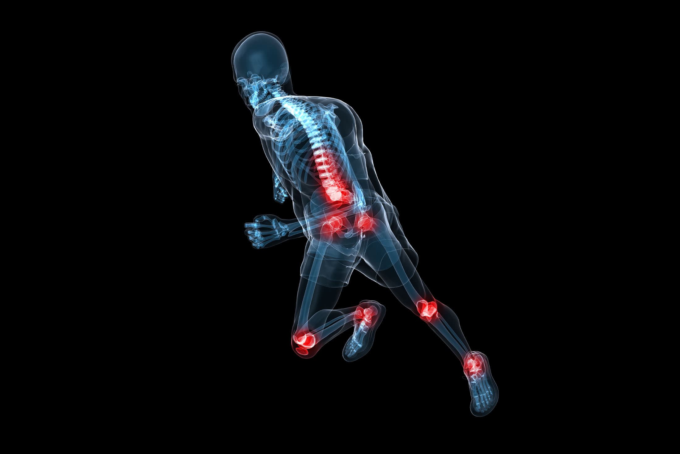 typical-areas-of-running-injuries_region-von-laufverletzungen-wo-wir-uns-beim-laufen-verletzen